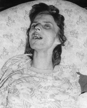 Аннелиза Михель. Неизвестный фотограф.