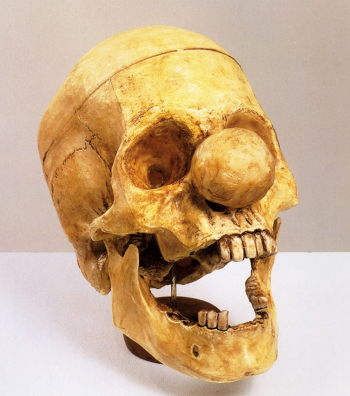 Вик Мунис. Череп клоуна. Серия `Реликвии`. 1987.
